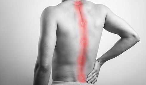 Różne urazy kręgosłupa prowadzą do bólu w okolicy lędźwiowej