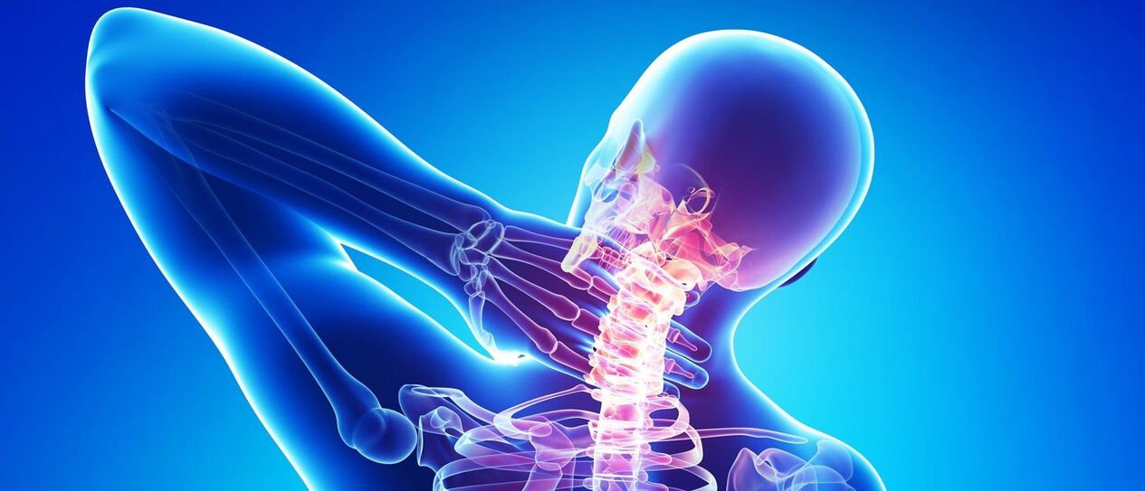 Osteochondroza szyjka macicy jest procesem patologicznym w obszarze kręgosłupa